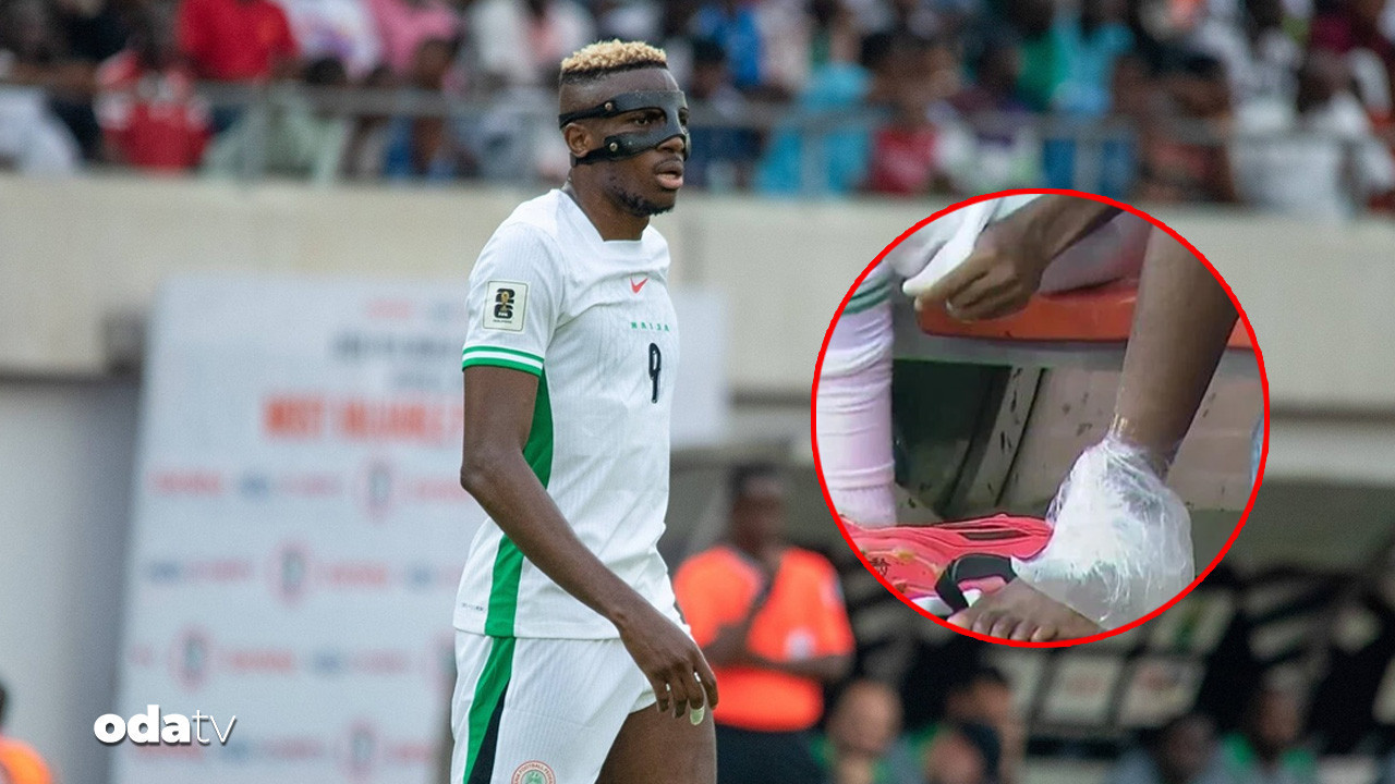 Victor Osimhen’den kötü haber